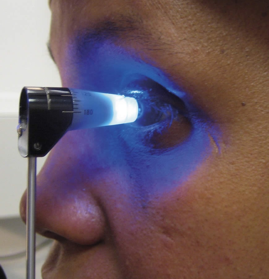 Tonometer voor het meten van de oogdruk